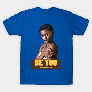 BE YOU  #ProudOfMySkin T-Shirt